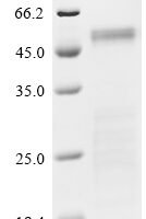 Severe acute respiratory syndrome coronavirus 2 Nucleoprotein (N) (P13L,Δ31-33,E136D,R203K,G204R,S413R), partial Recombinant Protein - BioCrest Sci