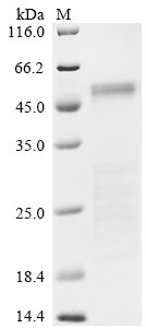 Severe acute respiratory syndrome coronavirus 2 Nucleoprotein (N) (P13L,Δ31-33,E136D,R203K,G204R,S413R), partial Recombinant Protein, Severe acute respiratory syndrome coronavirus 2 (2019-nCoV) (SARS-CoV-2), E.coli, N-terminal 6xHis-tagged, 49.5 kDa, purity >≥ 85% as determined by SDS-PAGE.