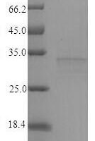 Brucella abortus HTH-type quorum sensing-dependent transcriptional regulator VjbR (vjbR) Recombinant Protein - BioCrest Sci