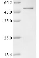 Xenopus laevis Transcription factor Sox-1 (sox1) Recombinant Protein - BioCrest Sci