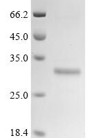 Human Fibroblast growth factor 21 (FGF21) Recombinant Protein - BioCrest Sci