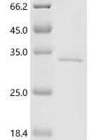 Influenza B virus Nucleoprotein (NP), partial Recombinant Protein, C-His, aa 1–245, Influenza B virus (strain B/Ann Arbor/1/1966 [wild-type]) - BioCrest Sci