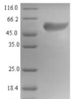 Human Islet cell autoantigen 1 (ICA1) Recombinant Protein, N-His - BioCrest Sci