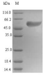 Human Islet cell autoantigen 1 (ICA1) Recombinant Protein, N-His, Homo sapiens (Human), E.coli, N-terminal 6xHis-tagged, 60.1 kDa, purity >≥ 85% as determined by SDS-PAGE.