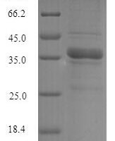 Human 60S ribosome subunit biogenesis protein NIP7 homolog (NIP7) Recombinant Protein - BioCrest Sci