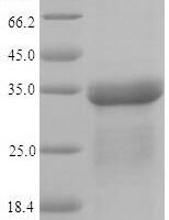 Escherichia coli Type-1 fimbrial protein, A chain (fimA) Recombinant Protein - BioCrest Sci