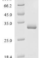 Human Kallikrein-2 (KLK2) Recombinant Protein, C-10His - BioCrest Sci