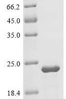 Human Nuclear factor related to kappa-B-binding protein (NFRKB), partial Recombinant Protein - BioCrest Sci