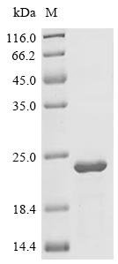 Human Nuclear factor related to kappa-B-binding protein (NFRKB), partial Recombinant Protein, E.coli, C-terminal 6xHis-tagged, 21.0 kDa, purity >≥ 95% as determined by SDS-PAGE.