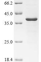 Mouse 17-beta-hydroxysteroid dehydrogenase 13 (Hsd17b13) Recombinant Protein - BioCrest Sci