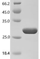 Human ETS translocation variant 5 (ETV5), partial Recombinant Protein - BioCrest Sci