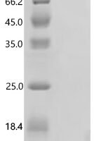 Macaca mulatta Vascular endothelial growth factor receptor 2 (KDR), partial Recombinant Protein - BioCrest Sci