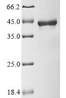 Human Signal-transducing adaptor protein 1 (STAP1) Recombinant Protein - BioCrest Sci