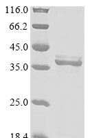 Rat Erythropoietin receptor (Epor), partial Recombinant Protein, N-His-GB1/C-His - BioCrest Sci