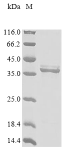 Rat Erythropoietin receptor (Epor), partial Recombinant Protein, N-His-GB1/C-His, Rattus norvegicus (Rat), E.coli, N-terminal 6xHis-GB1-tagged and C-terminal 6xHis-tagged, 36.6 kDa, purity >≥ 85% as determined by SDS-PAGE.