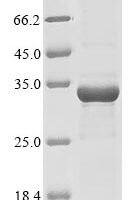 Bacillus thuringiensis subsp. Kurstaki Pesticidal crystal protein cry1Ia (cry1Ia), partial Recombinant Protein - BioCrest Sci