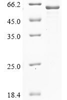 Mouse Cytochrome P450 3A25 (Cyp3a25) Recombinant Protein - BioCrest Sci