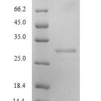 Mouse Kallikrein-8 (Klk8) Recombinant Protein, N-His, aa 33–260, E.coli - BioCrest Sci