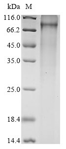 Mouse Keratinocyte proline-rich protein (Kprp) Recombinant Protein, Mus musculus (Mouse), E.coli, N-terminal 10xHis-tagged, 75.8 kDa, purity >≥ 85% as determined by SDS-PAGE.