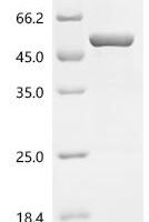 Mouse 2-oxoisovalerate dehydrogenase subunit alpha, mitochondrial (Bckdha) Recombinant Protein - BioCrest Sci