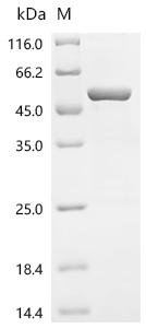 Mouse 2-oxoisovalerate dehydrogenase subunit alpha, mitochondrial (Bckdha) Recombinant Protein, Mus musculus (Mouse), E.coli, N-terminal 6xHis-tagged, 52.6 kDa, purity >≥ 95% as determined by SDS-PAGE.