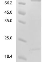 Human NAD(+) hydrolase SARM1 (SARM1) Recombinant Protein, N-His/C-His - BioCrest Sci