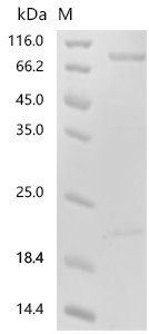 Human NAD(+) hydrolase SARM1 (SARM1) Recombinant Protein, N-His/C-His, Homo sapiens (Human), E.coli, N-terminal 6xHis-tagged and C-terminal 6xHis-tagged, 86.4 kDa, purity >≥ 85% as determined by SDS-PAGE.