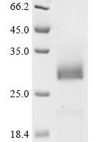 Human Insulin-like growth factor-binding protein 7 (IGFBP7) Recombinant Protein, N-His - BioCrest Sci