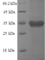 Human Metalloreductase STEAP1 (STEAP1), partial Recombinant Protein - BioCrest Sci