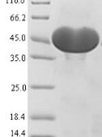 Human ATP-citRate synthase (ACLY), partial Recombinant Protein - BioCrest Sci