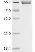 Human Leucine-rich repeat serine/threonine-protein kinase 2 (LRRK2), partial Recombinant Protein, C-His, aa 904–1450 - BioCrest Sci