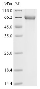 Human Leucine-rich repeat serine/threonine-protein kinase 2 (LRRK2), partial Recombinant Protein, C-His, aa 904–1450, Homo sapiens (Human), E.coli, C-terminal 6xHis-tagged, 69.3 kDa, purity >≥ 85% as determined by SDS-PAGE.