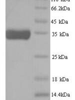 Caenorhabditis elegans ATP-dependent (S)-NAD (P)H-hydRate dehydRatase (R107.2) Recombinant Protein - BioCrest Sci