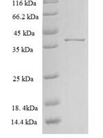 Rat Zinc transporter ZIP13 (Slc39a13), partial Recombinant Protein - BioCrest Sci