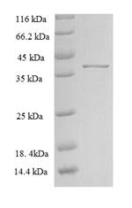Rat Zinc transporter ZIP13 (Slc39a13), partial Recombinant Protein, Rattus norvegicus (Rat), E.coli, N-terminal 6xHis-GST-tagged, 41.2 kDa, purity >≥ 90% as determined by SDS-PAGE.