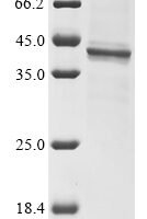 Varicella-zoster virus Envelope glycoprotein B (gB), partial Recombinant Protein, C-His - BioCrest Sci