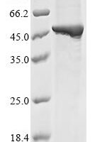 Mouse Guanine nucleotide-binding protein subunit alpha-12 (Gna12) Recombinant Protein - BioCrest Sci