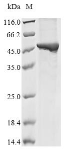 Mouse Guanine nucleotide-binding protein subunit alpha-12 (Gna12) Recombinant Protein, Mus musculus (Mouse), E.coli, N-terminal 10xHis-tagged and C-terminal Myc-tagged, 51.5 kDa, purity >≥ 85% as determined by SDS-PAGE.