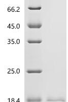 Rat Zymogen granule membrane protein 16 (Zg16) Recombinant Protein, N-His, aa 17–167, Yeast - BioCrest Sci