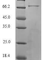 Bovine Selenoprotein P (SELENOP) (U59S,U297S,U307S,U338S,U350S,U363S,U365S,U372S,U388S,U390S,U397S,U399S) Recombinant Protein - BioCrest Sci