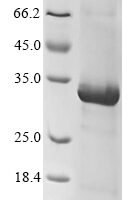 Human Killer cell immunoglobulin-like receptor 2DL5A (KIR2DL5A), partial Recombinant Protein - BioCrest Sci