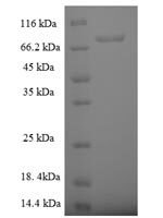 Human Rab5 GDP/GTP exchange factor (RABGEF1) Recombinant Protein - BioCrest Sci