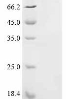 Rat Serum albumin (Alb),Biotinylated Recombinant Protein - BioCrest Sci