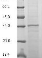 Macaca mulatta Chemokine CCL20/MIP-3ALPHA (CCL20) Recombinant Protein, N-10His-GST - BioCrest Sci