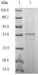 Macaca mulatta Chemokine CCL20/MIP-3ALPHA (CCL20) Recombinant Protein, N-10His-GST, Macaca mulatta (Rhesus macaque), E.coli, N-terminal 10xHis-GST-tagged, 36.6 kDa, purity >≥ 90% as determined by SDS-PAGE.