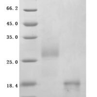 Human Glucagon-like peptide 1 receptor (GLP1R), partial Recombinant Protein, N-His-tagged/Tag-Free - BioCrest Sci