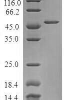 Human Tumor protein D53 (TPD52L1) Recombinant Protein - BioCrest Sci