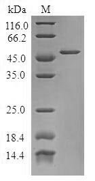 Human Tumor protein D53 (TPD52L1) Recombinant Protein, Homo sapiens (Human), E.coli, N-terminal GST-tagged, 49.4 kDa, purity >≥ 90% as determined by SDS-PAGE.