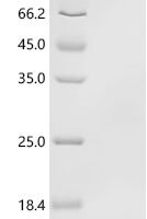 Japanese encephalitis virus Envelope protein(E), partial Recombinant Protein - BioCrest Sci