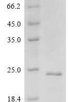 Drosophila melanogaster FMRFamide receptor (FMRFaR), partial Recombinant Protein - BioCrest Sci